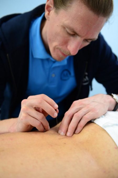 MOVENDUS-Dry-Needling-683x1024.jpg
